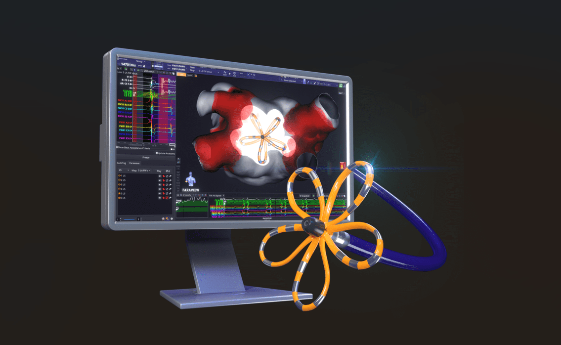 PFA Ablation bei Vorhofflimmern (München) PFA Ablation bei Vorhofflimmern